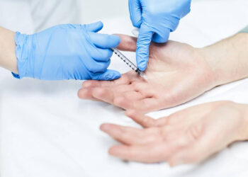 Botulinum Toksin ile Terleme Tedavisi