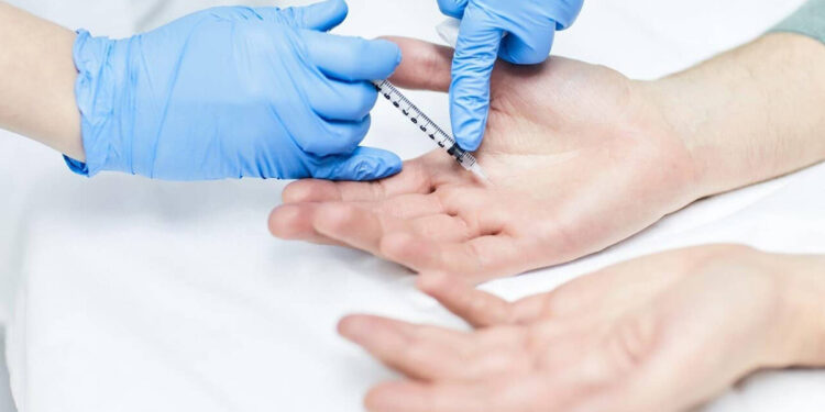 Botulinum Toksin ile Terleme Tedavisi